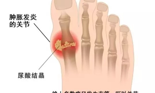 肛门用药后可以同房嘛-肛门上药栓能不能晚上上一种早上上一种-肛门上药栓能不能晚上上一种早上上一种,中国晚上肛门用药早上流出来正常吗网站